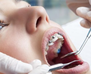 L’orthodontie en quelques mots